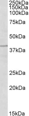 IHC-plus™ TRIM5 Antibody (N-Terminus)