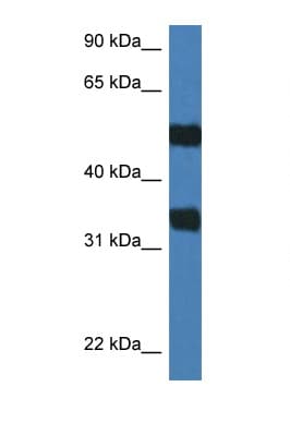 ARSG / Arylsulfatase G Antibody (aa388-437)