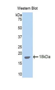 IL15 Antibody (aa49-162)