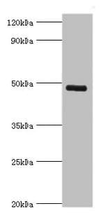 KCNN4 / KCa3.1 Antibody (aa288-427)