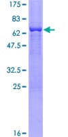 Human SORD / Sorbitol Dehydrogenase Protein (Recombinant GST)