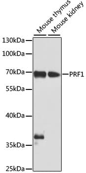 Polyclonal Rabbit anti-Human PRF1 / Perforin Antibody (IHC, IF, WB)