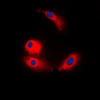 Polyclonal Rabbit anti-Human ARMC6 Antibody (C-Terminus, IF, WB)