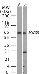 SOCS5 Antibody