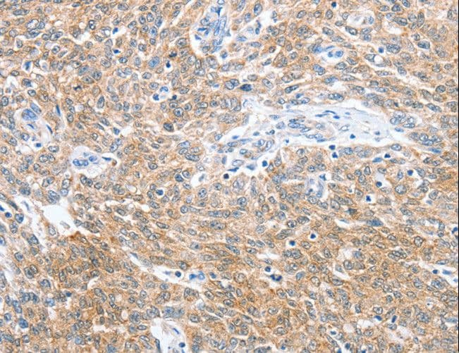 CKAP2 Antibody