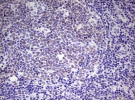 Monoclonal Mouse anti-Human EZH2 Antibody (clone OTI10B10, aa182-431, IHC, WB)