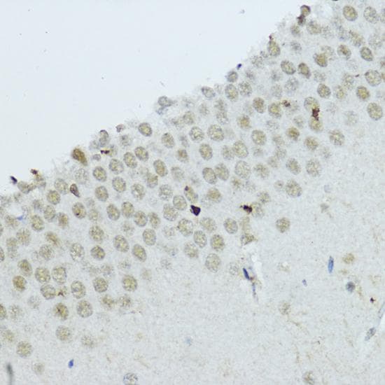 NR1I3 / CAR Antibody