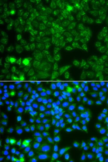 GBA3 / CBG Antibody