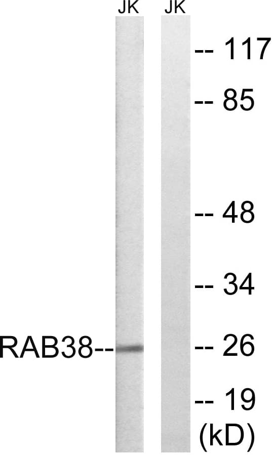 IHC-plus™ RAB38 Antibody (aa80-129)