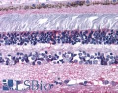 PathPlus™ Polyclonal Rabbit anti-Human Prostaglandin D2 Receptor Antibody (N-Terminus, IHC)