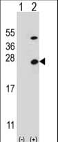 IHC-plus™ ATP5O Antibody (aa38-64)