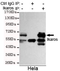 IHC-plus™ Monoclonal Mouse anti-Human IKZF1 / IKAROS Antibody (clone 1A12-F2-D8, IHC, WB)
