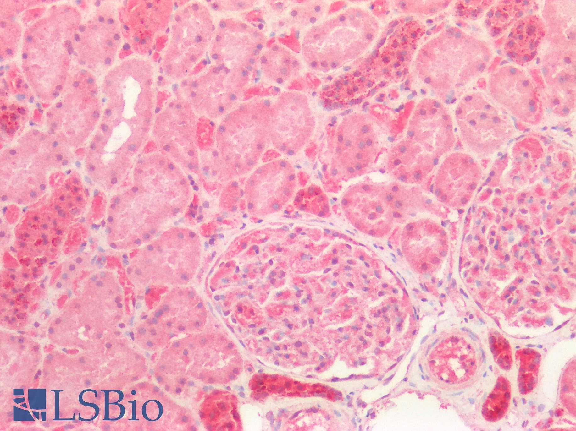 IHC-plus™ Polyclonal Rabbit anti-Human CTSD / Cathepsin D Antibody (IHC, IF, WB)