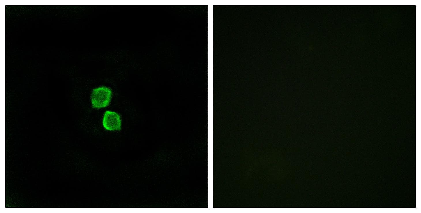 CMTM1 Antibody