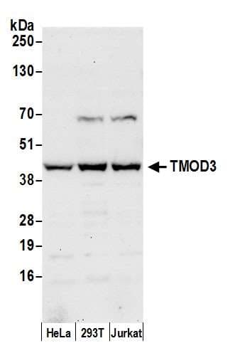 TMOD3 / Tropomodulin 3 Antibody (aa150-200)