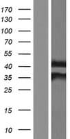 NAT1 / AAC1 Protein (Over-Expression Lysate Myc-DDK (Flag))