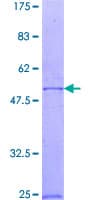 Human RAB23 Protein (Recombinant GST)