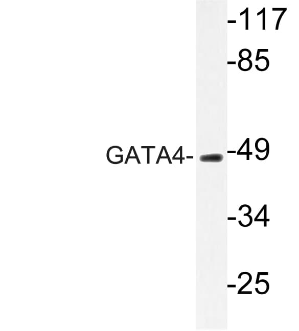 GATA4 Antibody (Pro101)
