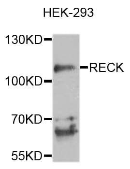 Polyclonal Rabbit anti-Human RECK Antibody (IHC, WB)