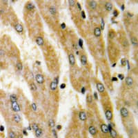 Polyclonal Rabbit anti-Human ACSL6 Antibody (Internal, IHC, WB)