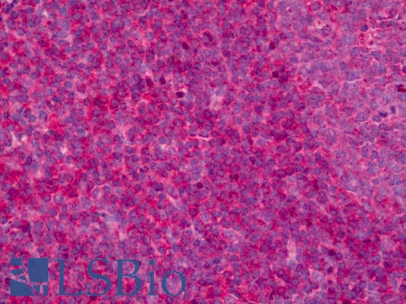 IHC-plus™ Leukotriene B4 Receptor / BLT1 Antibody