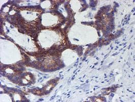 Monoclonal Mouse anti-Human ERBB2 / HER2 Antibody (clone OTI12G4, Carrier-free, aa676-1255, IHC, IF, WB)