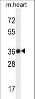 TMBIM4 / GAAP Antibody (aa1-30)