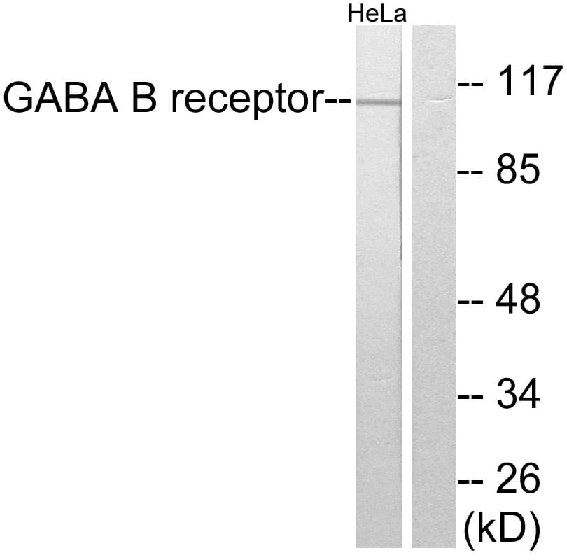 Polyclonal Rabbit anti-Human GABBR1 / GABA B Receptor 1 Antibody (aa871-920, IHC, WB)