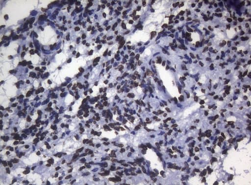 BCL6 Antibody (aa1-300, clone OTI1C3, Carrier-free)