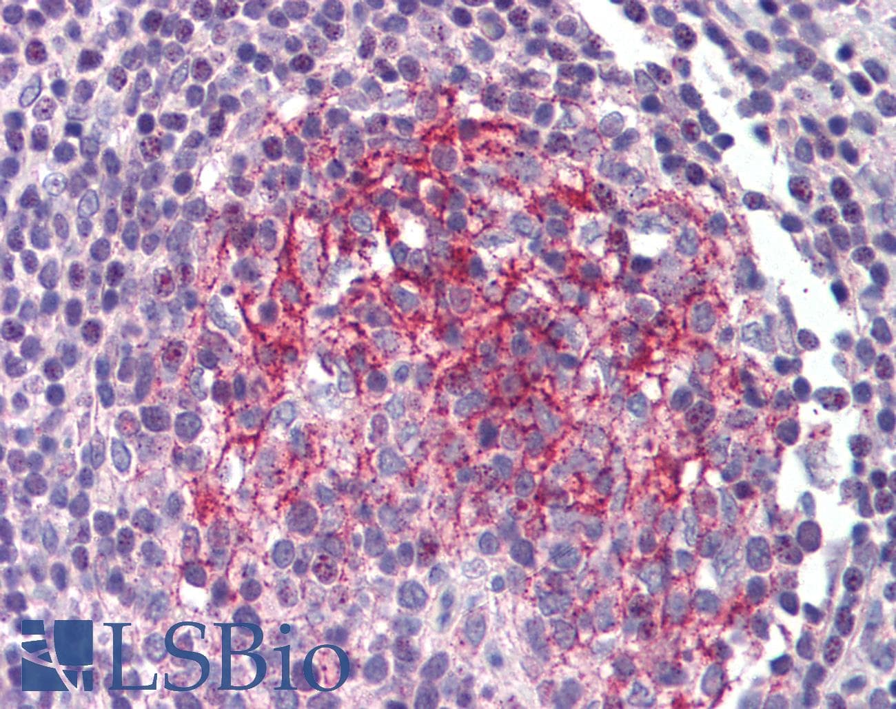 IHC-plus™ CD121b / IL1R2 Antibody