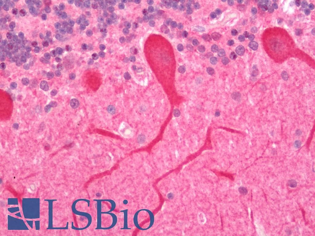 IHC-plus™ Polyclonal Rabbit anti-Human NPHS1 / Nephrin Antibody (IHC, IF, WB)