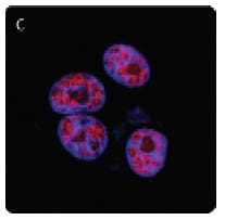 PARP1 Antibody (N-Terminus, clone 5A5)