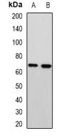 Polyclonal Rabbit anti-Human MTA3 Antibody (WB)