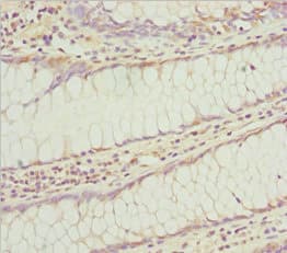 KLHL7 Antibody