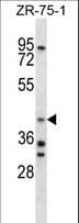 Polyclonal Rabbit anti-Human ARA9 / AIP Antibody (aa293-321, IHC, WB)