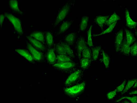 Polyclonal Rabbit anti-Human TNP1 / TP1 Antibody (IF)
