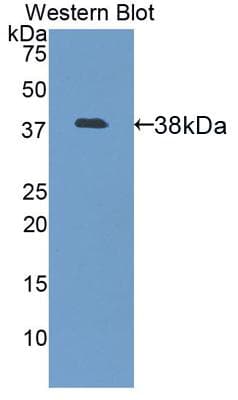 Lumican Antibody (aa19-338)