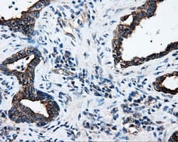 SRR / Serine Racemase Antibody (clone OTI1D7)