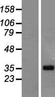 LUZP4 Protein (Over-Expression Lysate Myc-DDK (Flag))