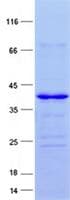 Human HOXC10 Protein (Recombinant His, N-Terminal)