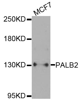 Polyclonal Rabbit anti-Human PALB2 Antibody (WB)