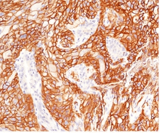 EGFR Antibody (clone ERB68-1, Azide-free, BSA-free)
