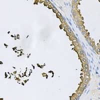 APG5 / ATG5 Antibody