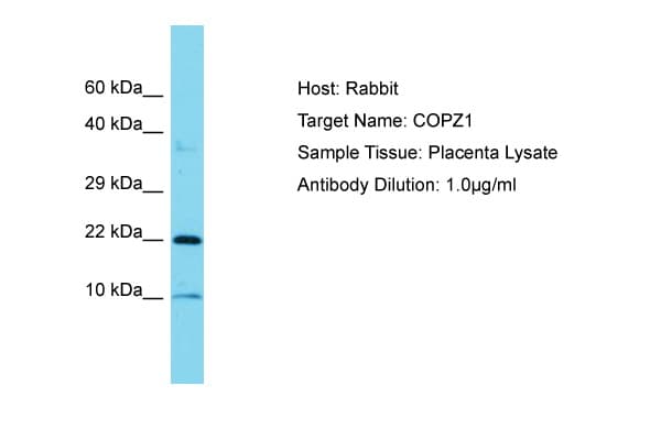 Polyclonal Rabbit anti-Human COPZ1 Antibody (C-Terminus, WB)