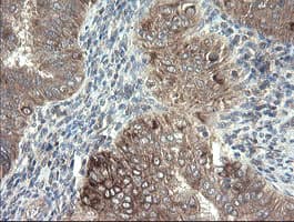 DPH2 Antibody (clone OTI2B12)