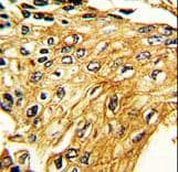 Polyclonal Rabbit anti-Human IFNGR2 Antibody (aa308-337, IHC, WB)