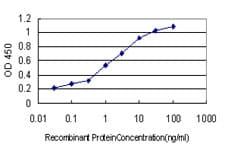IHC-plus™ TSG101 Antibody (clone 5B7)