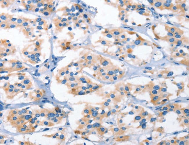 AHR Antibody