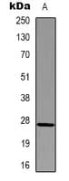 HSPB1 / HSP27 Antibody