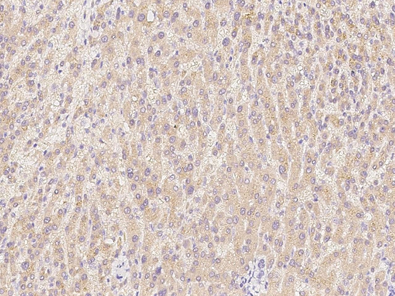 Monoclonal Mouse anti-Human ASGR1 / ASGPR Antibody (clone 02, Preservative Free, IHC)